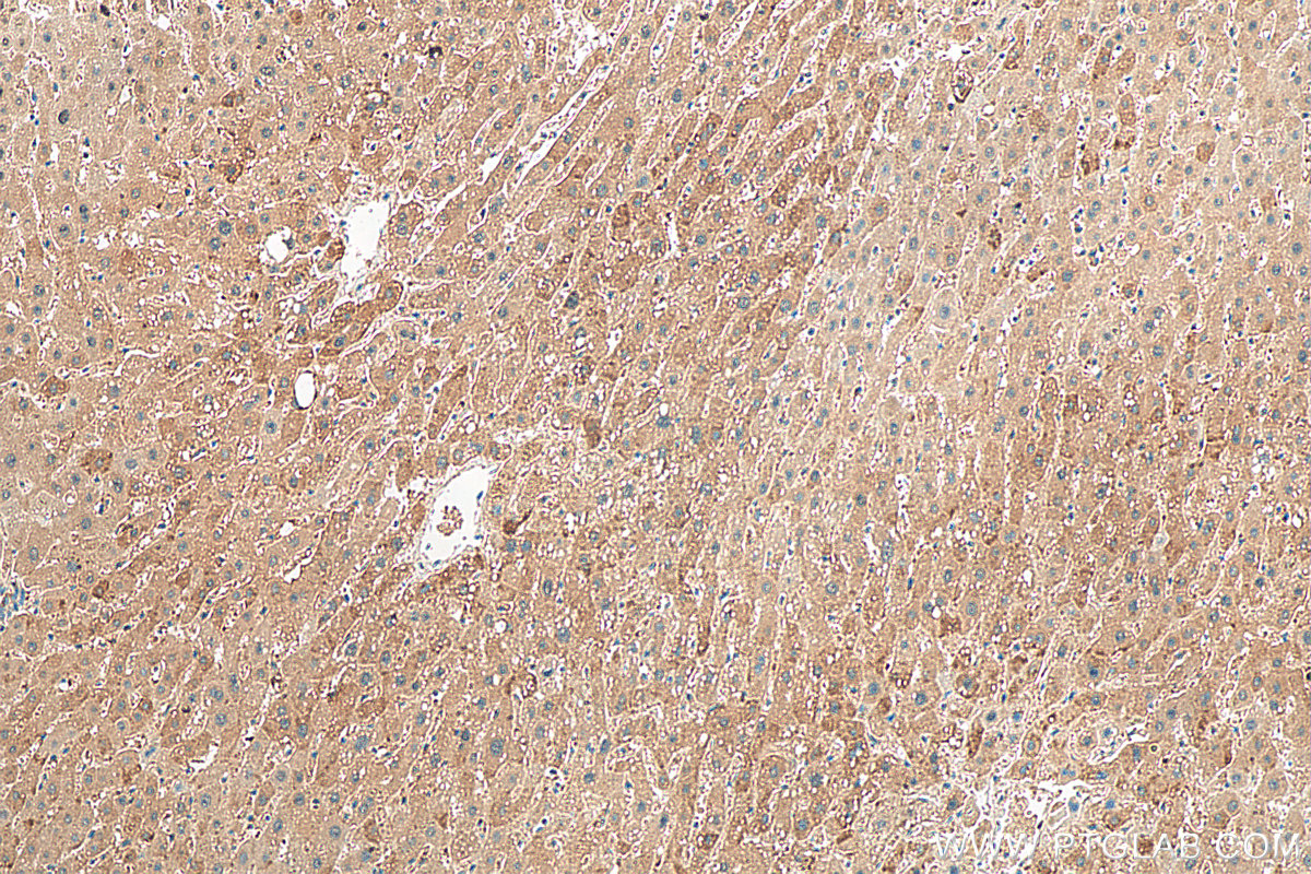 IHC staining of human liver using 14927-1-AP