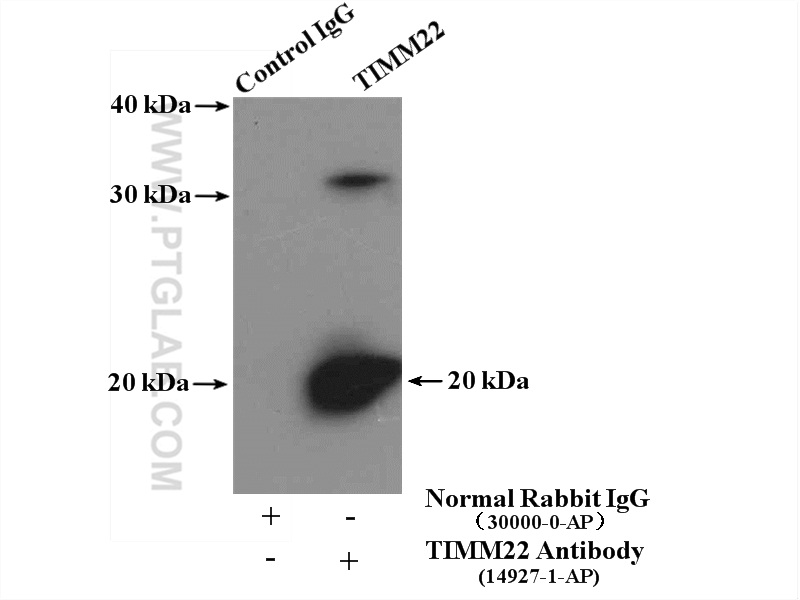 IP experiment of mouse liver using 14927-1-AP