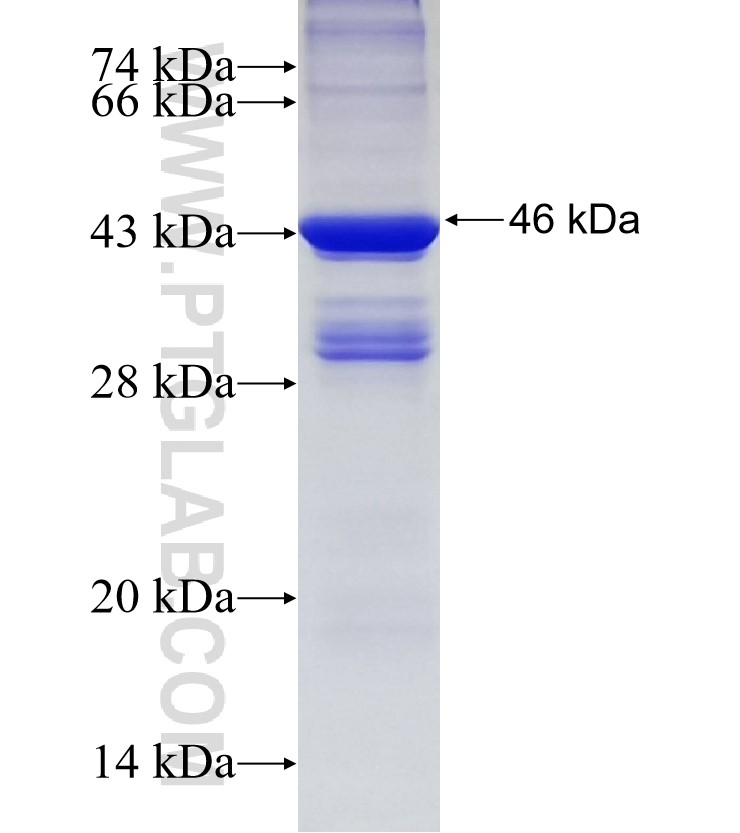 TIMM22 fusion protein Ag6689 SDS-PAGE