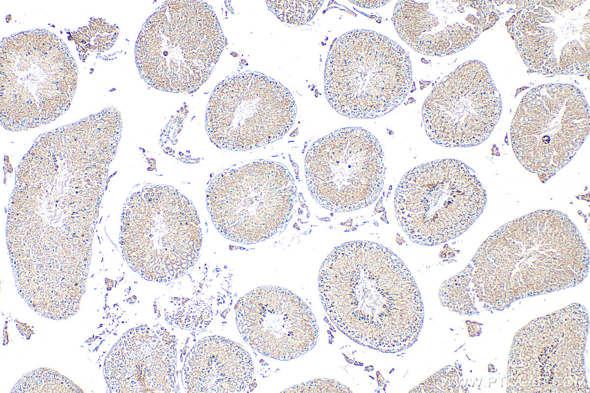 IHC staining of mouse testis using 11123-1-AP