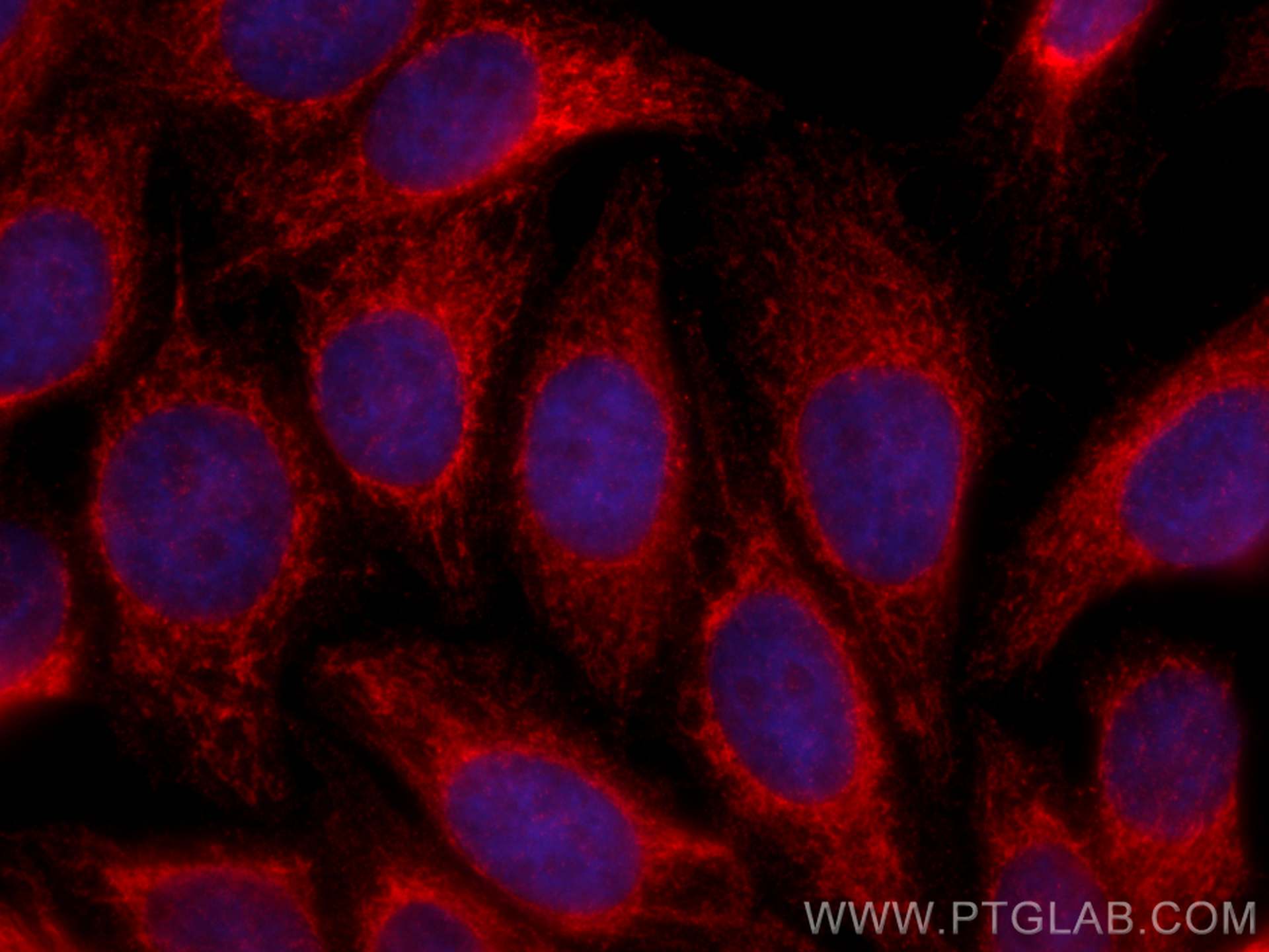 IF Staining of HepG2 using 66149-1-Ig (same clone as 66149-1-PBS)