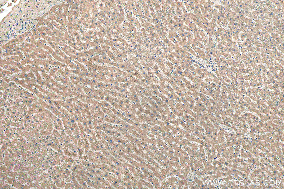 IHC staining of human liver using 66149-1-Ig