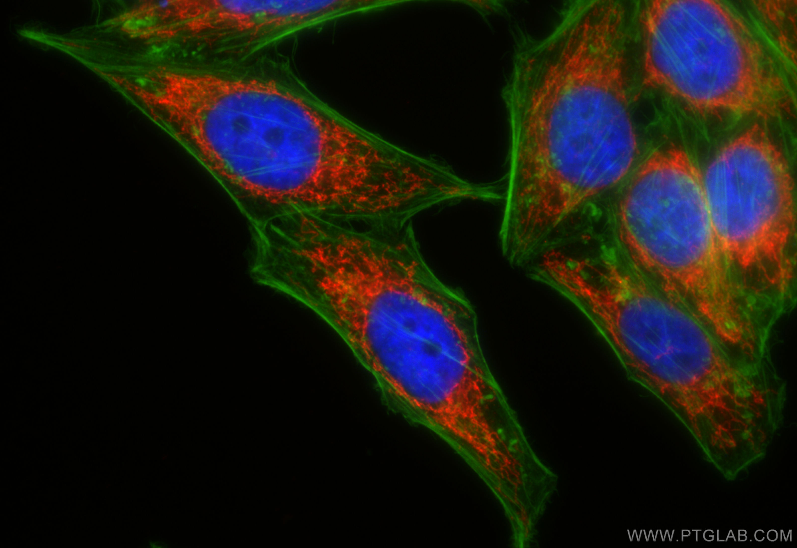 IF Staining of HepG2 using CL594-85134-5