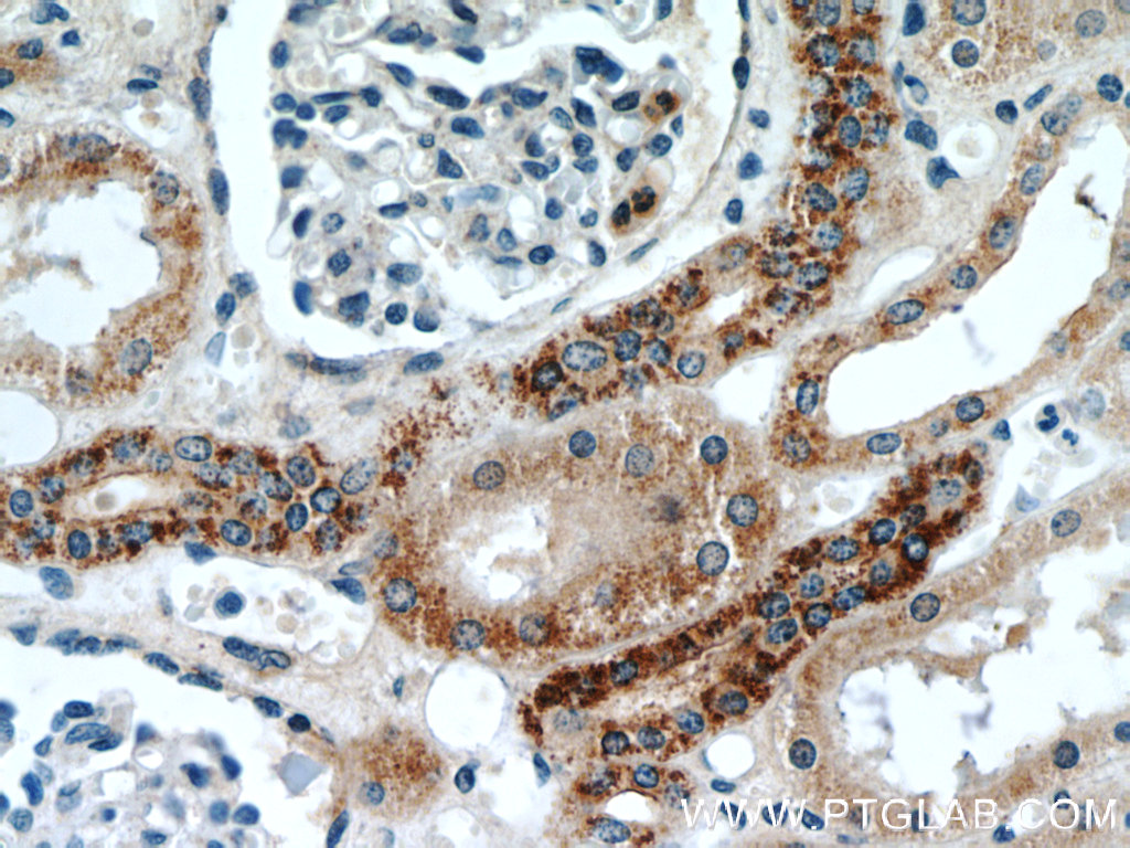 IHC staining of human kidney using 22229-1-AP