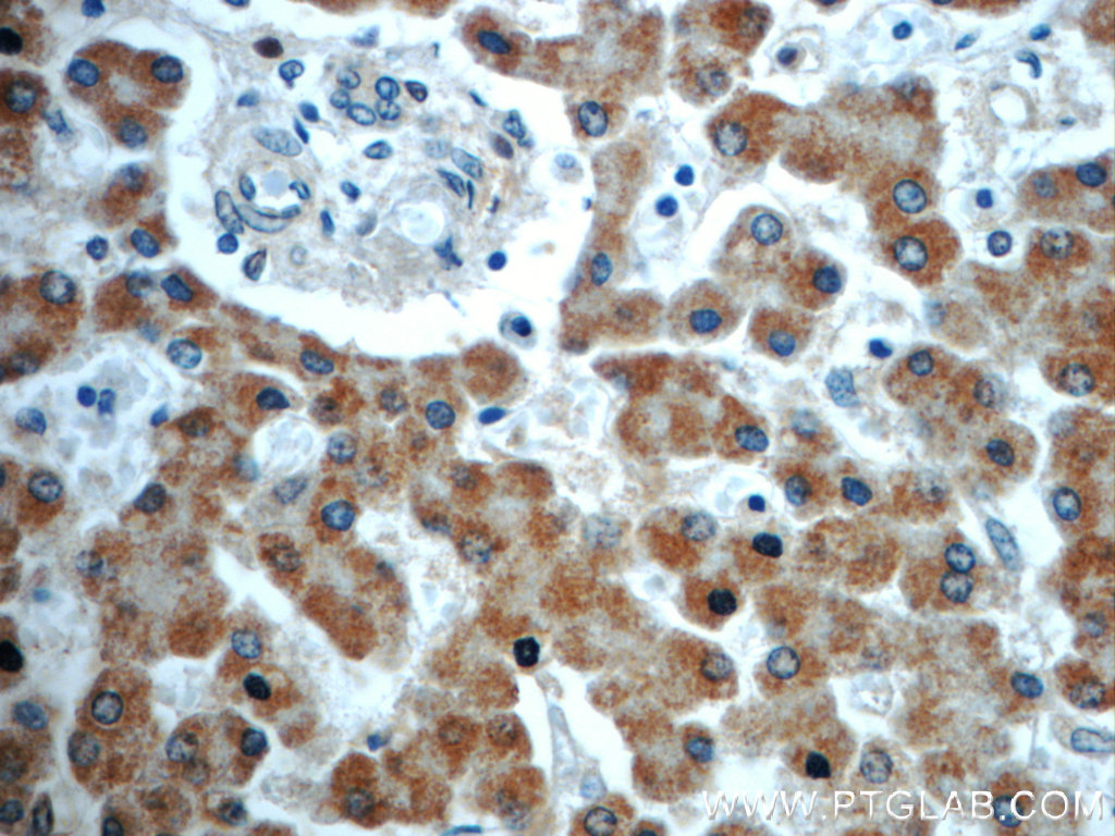 IHC staining of human liver using 22229-1-AP