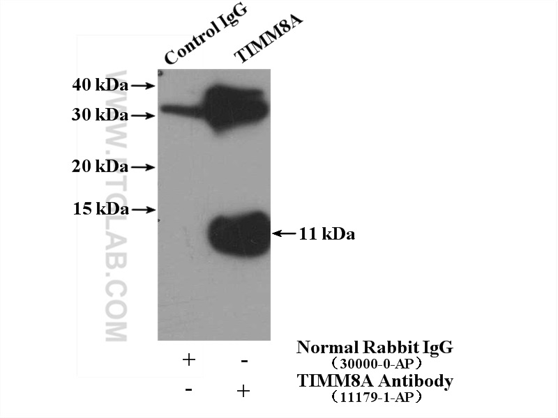 IP experiment of mouse testis using 11179-1-AP