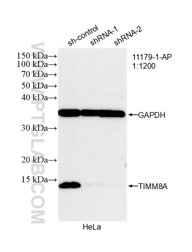 WB analysis of HeLa using 11179-1-AP WB analysis of HeLa using 11179-1-AP