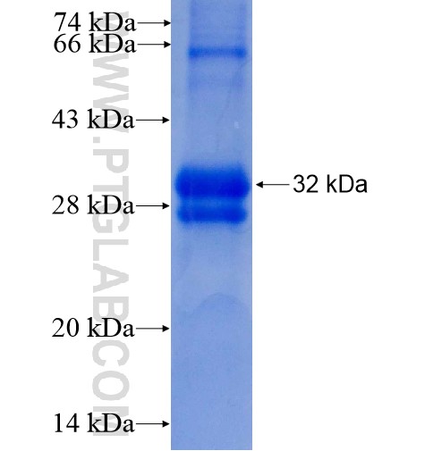 TIMM8B fusion protein Ag6521 SDS-PAGE