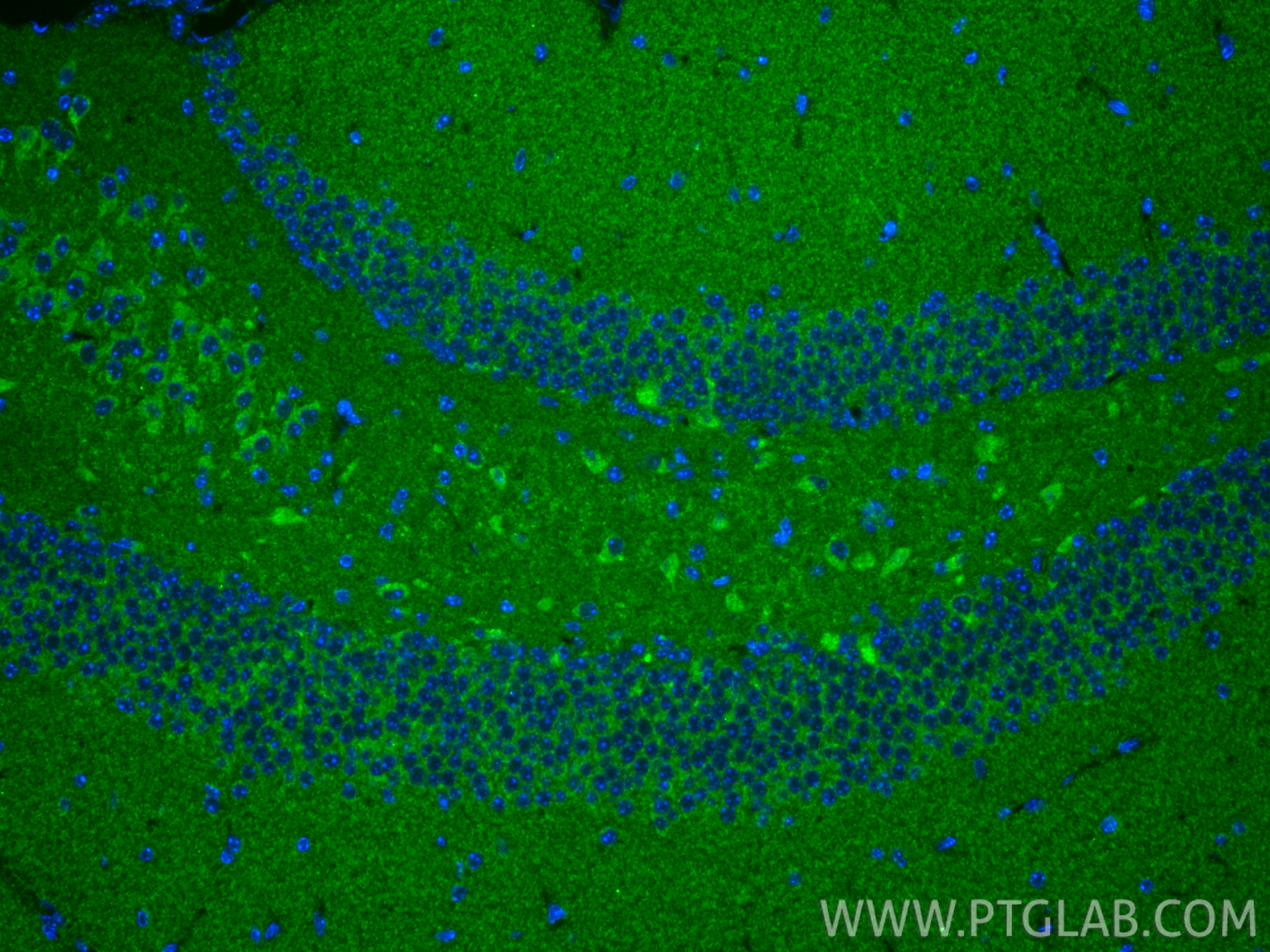 IF Staining of mouse brain using 11479-1-AP IF Staining of mouse brain using 11479-1-AP