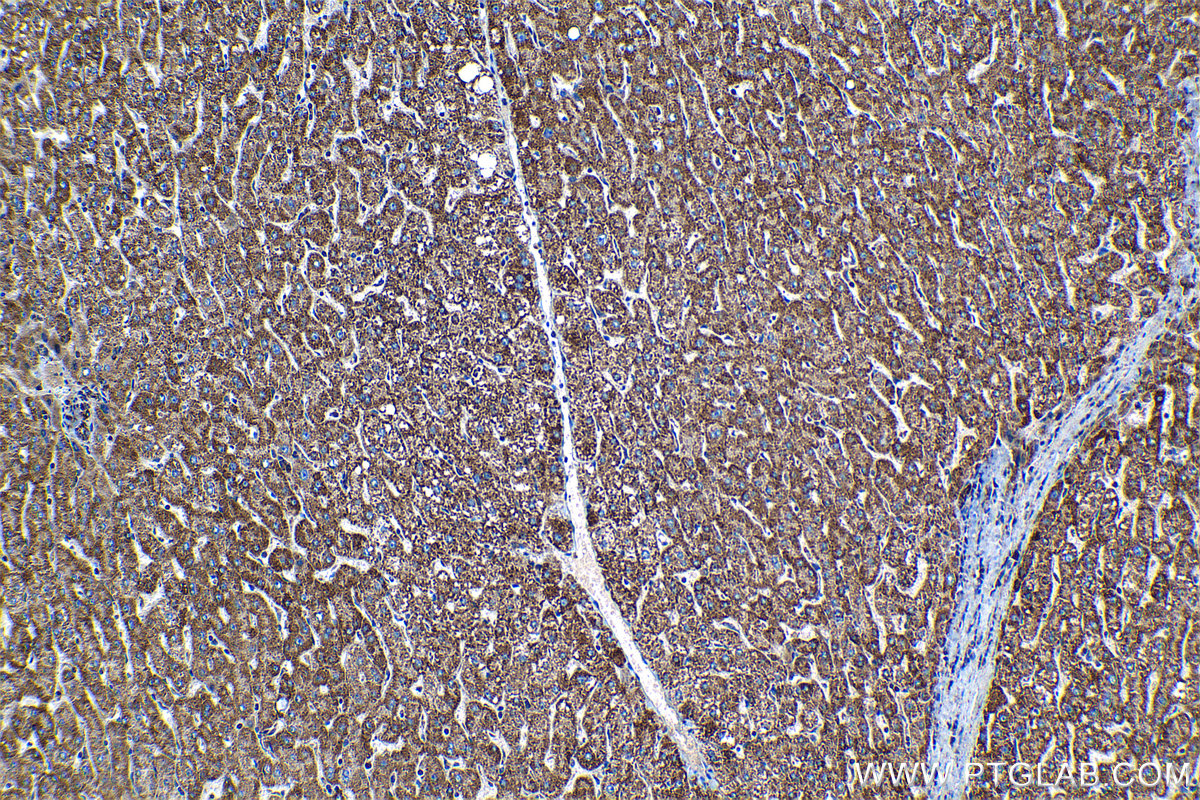 IHC staining of human liver using 11479-1-AP