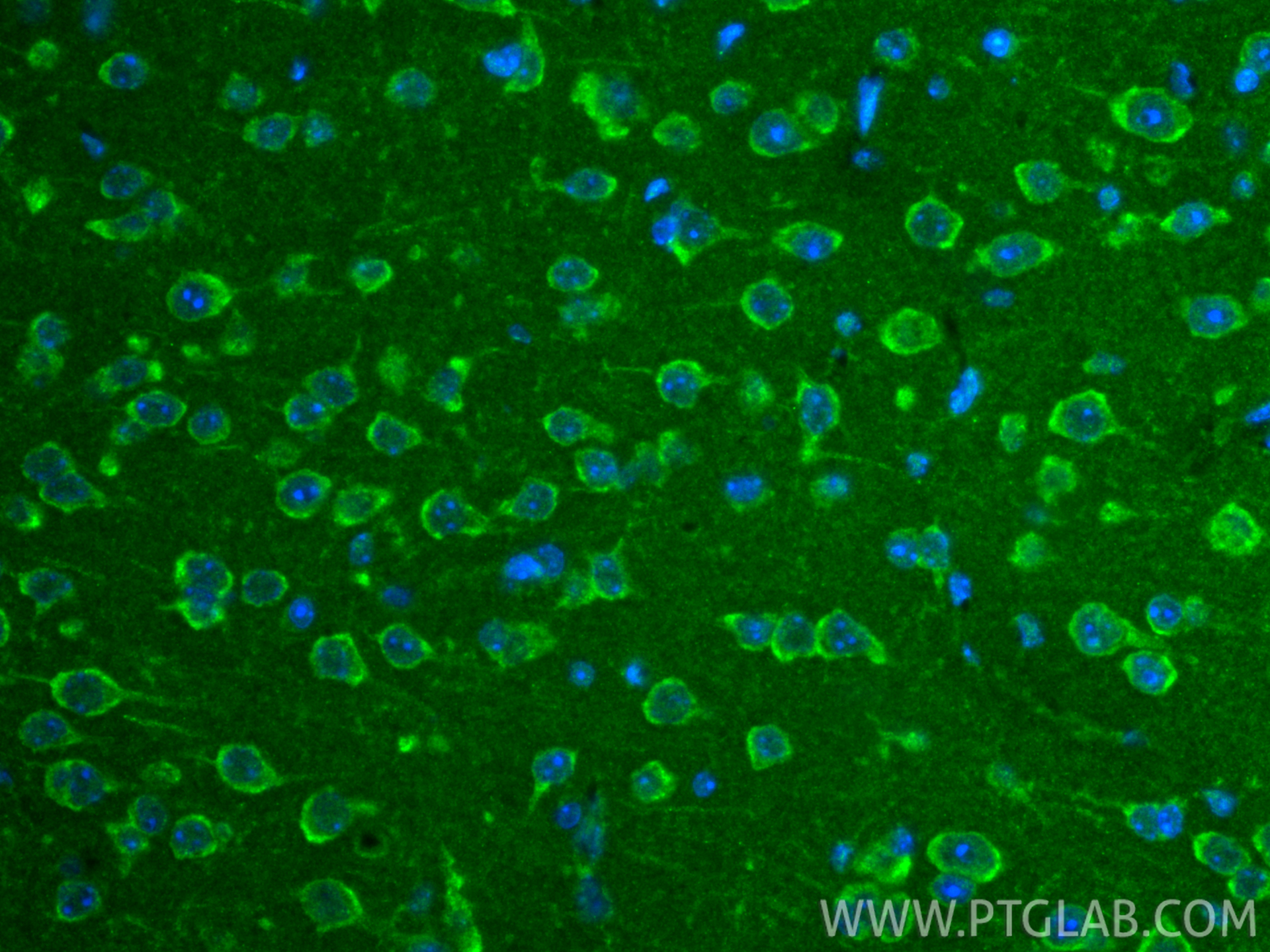 IF Staining of mouse brain using 23622-1-AP IF Staining of mouse brain using 23622-1-AP