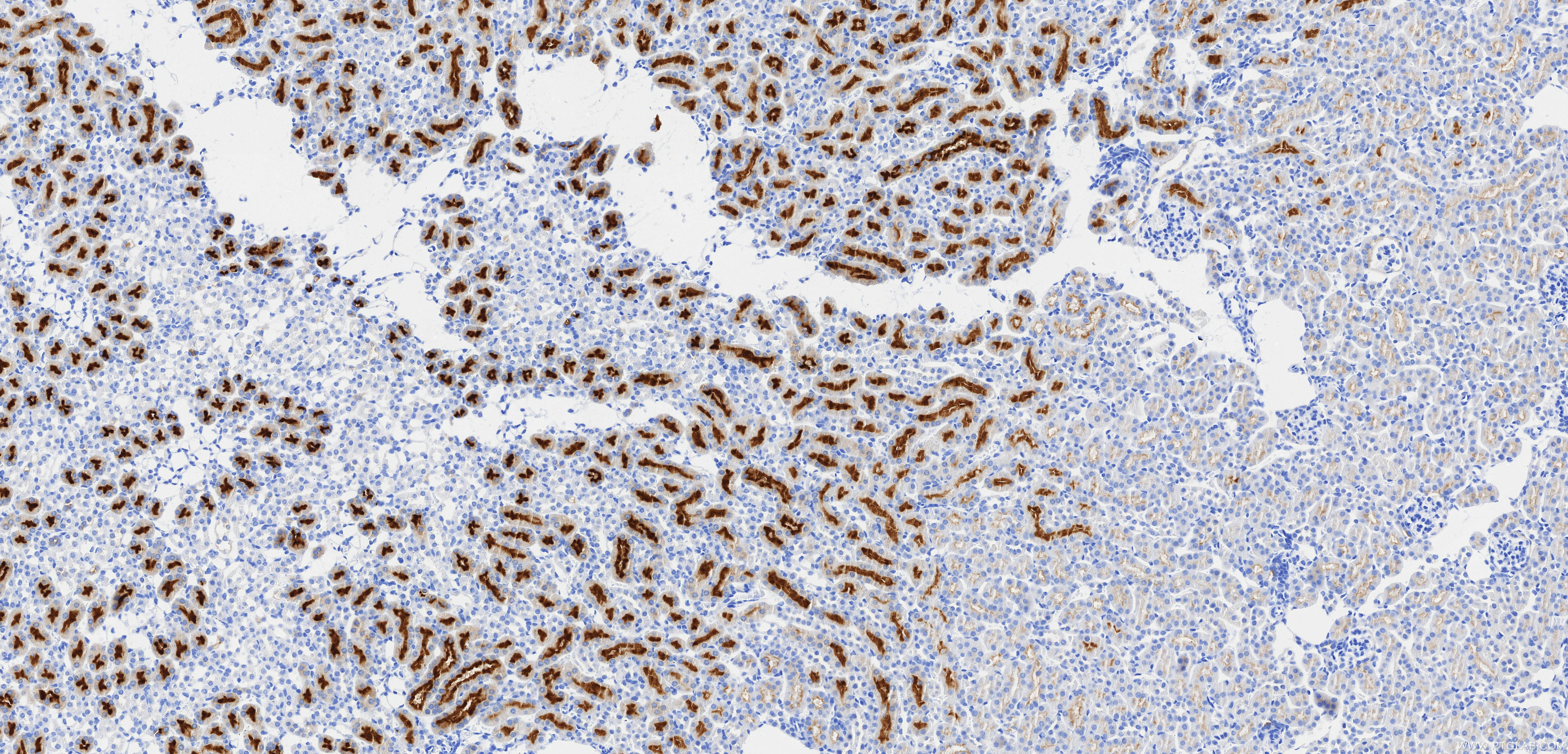 IHC staining of mouse kidney using 85959-1-RR