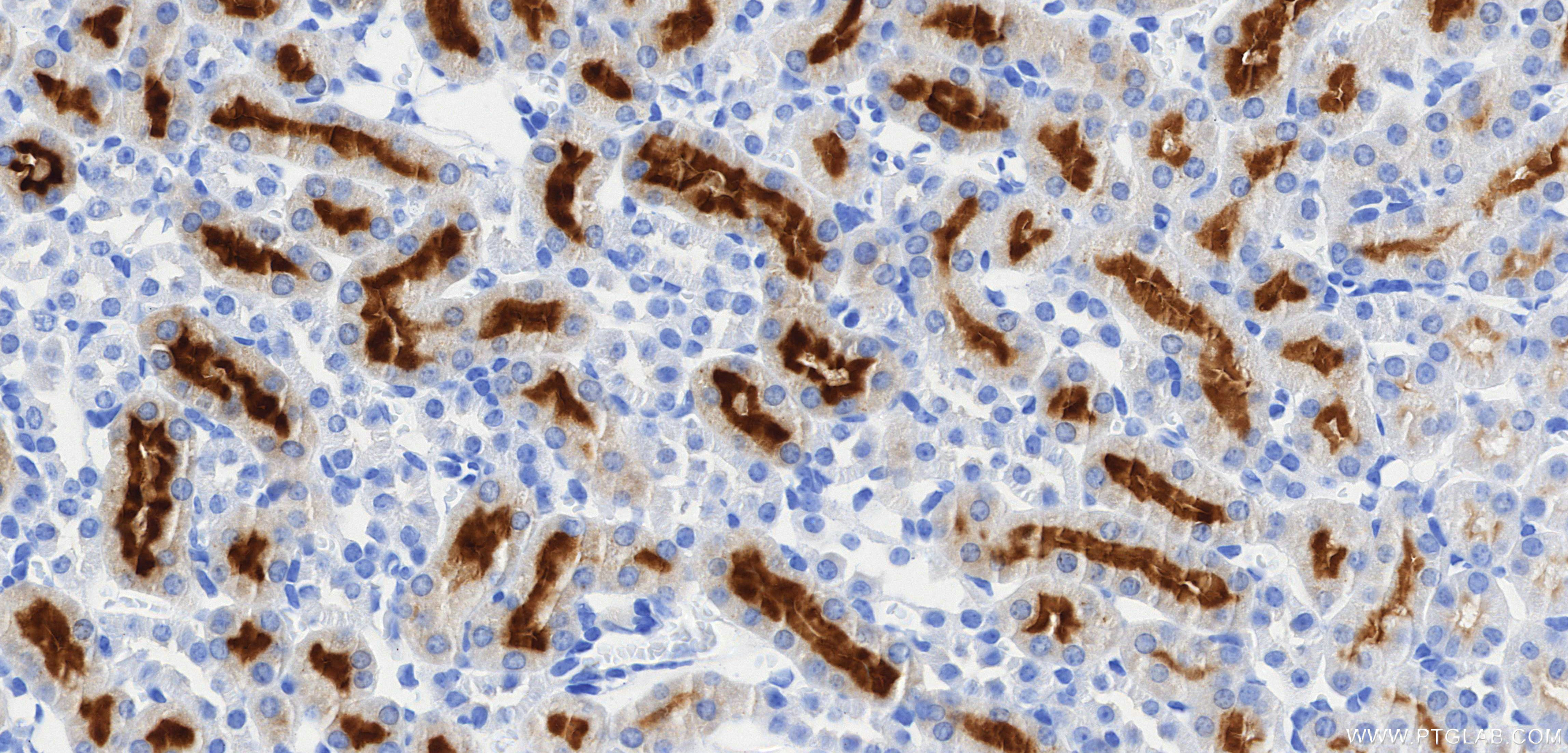 IHC staining of mouse kidney using 85959-1-RR