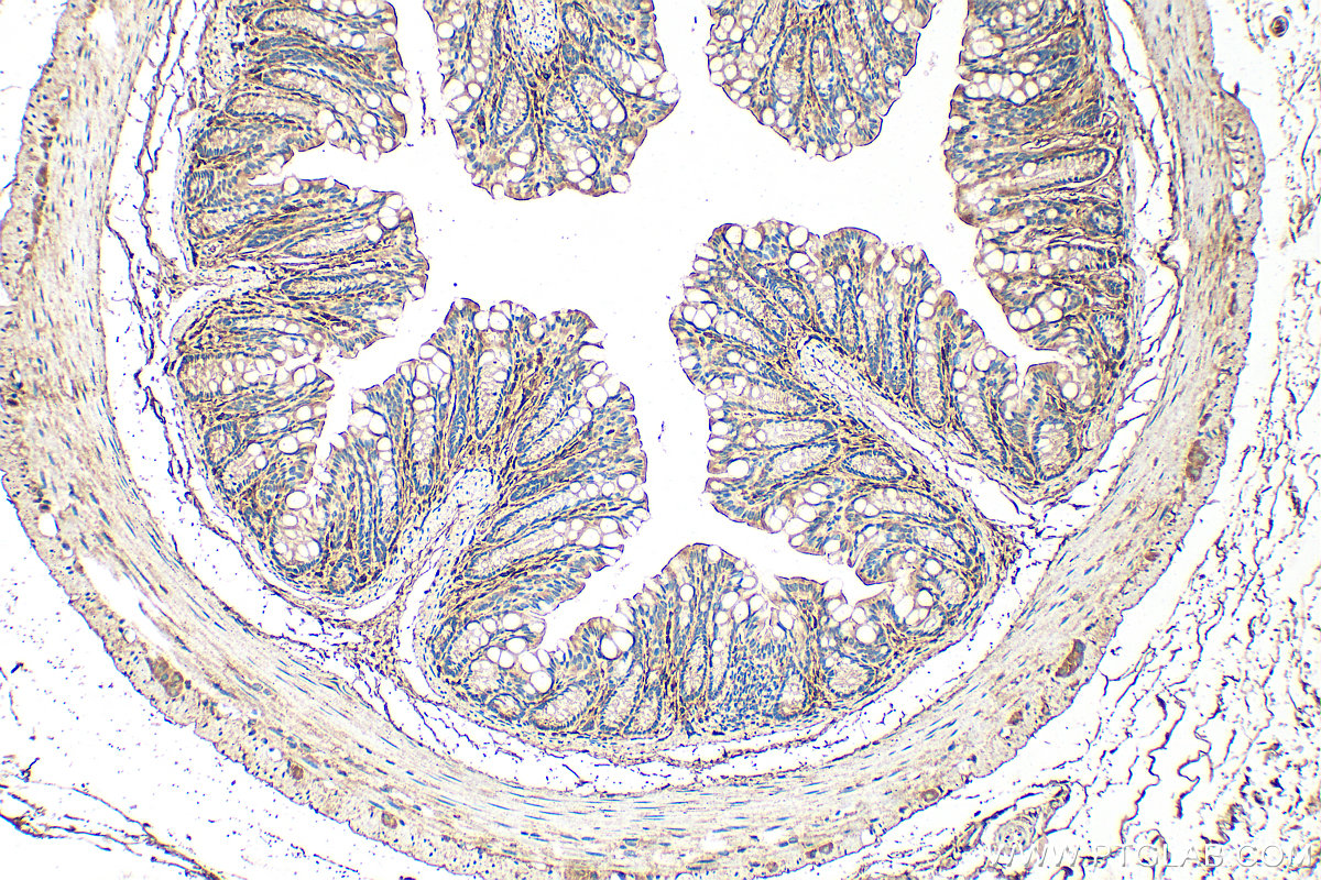 IHC staining of mouse colon using 26847-1-AP