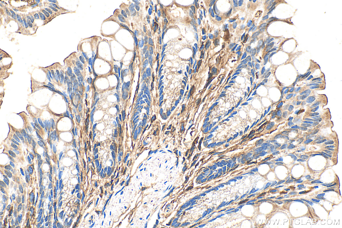 IHC staining of mouse colon using 26847-1-AP