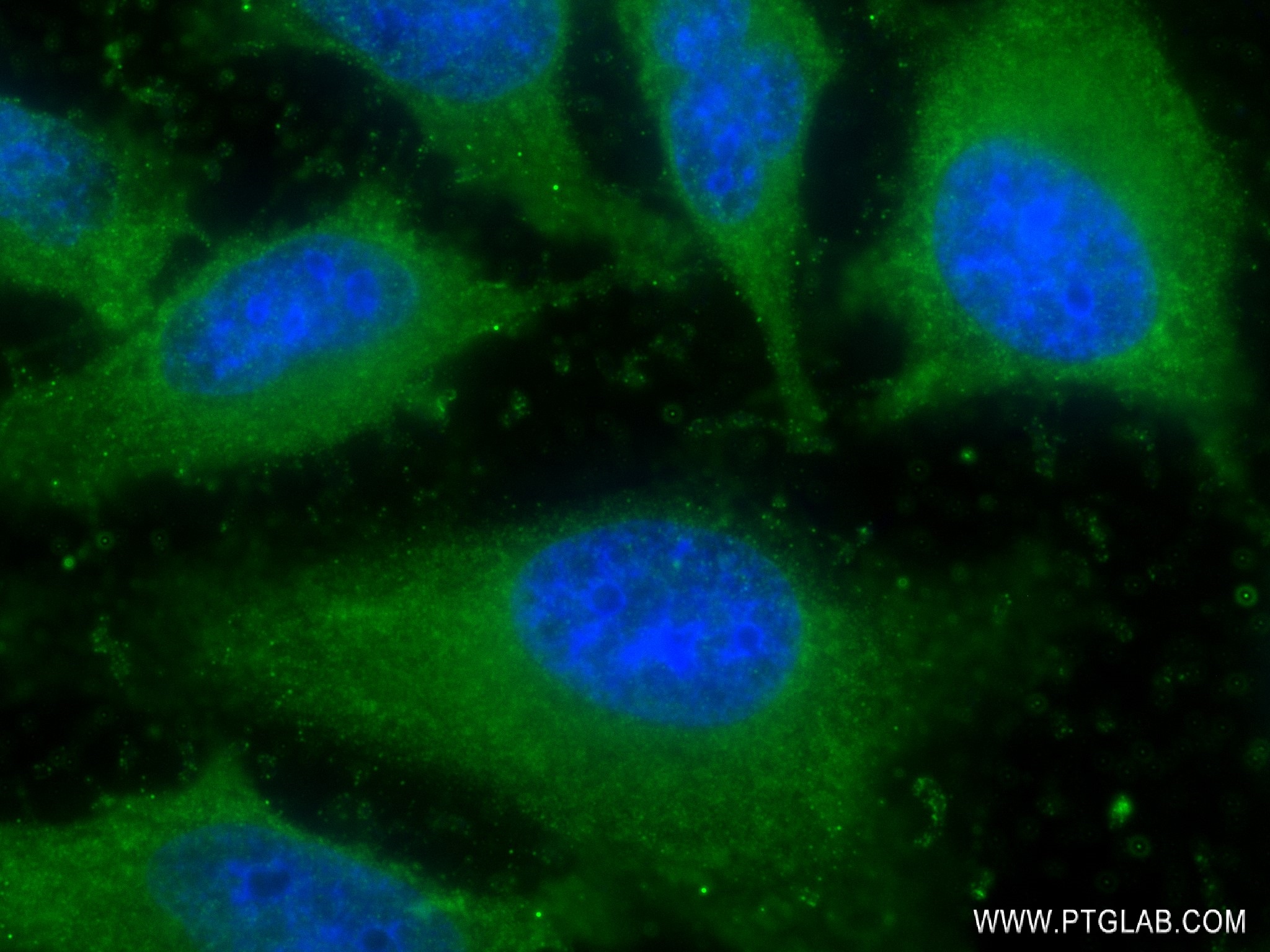 IF Staining of HeLa using 83151-5-RR