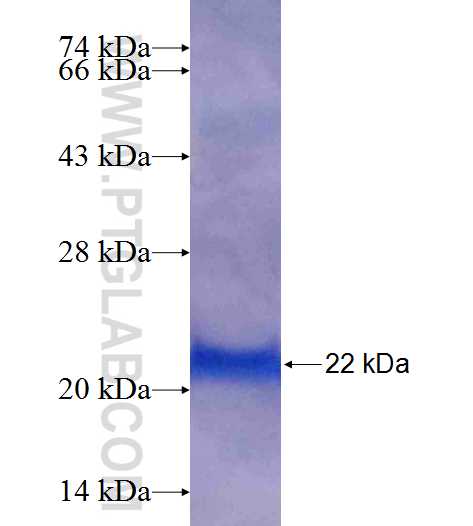 TIMP1 fusion protein Ag25395 SDS-PAGE