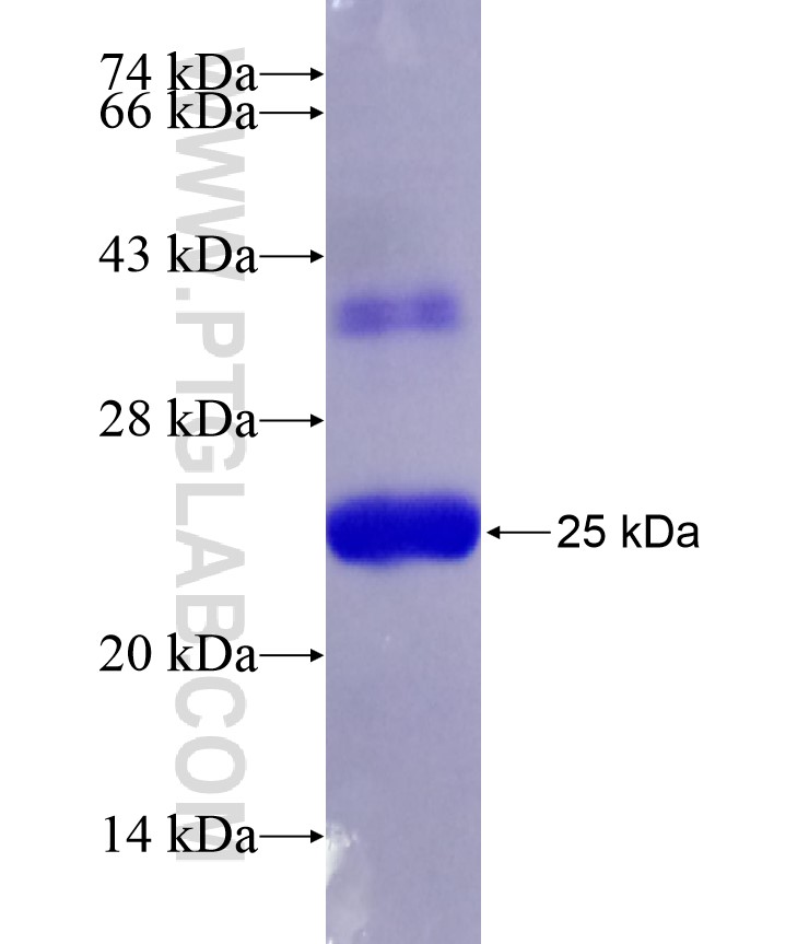 TIMP1 fusion protein Ag18348 SDS-PAGE TIMP1 fusion protein Ag18348 SDS-PAGE