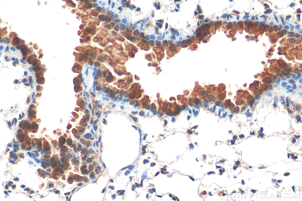 IHC staining of mouse lung using 17353-1-AP