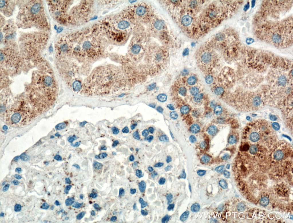 TIMP-2 Polyclonal antibody