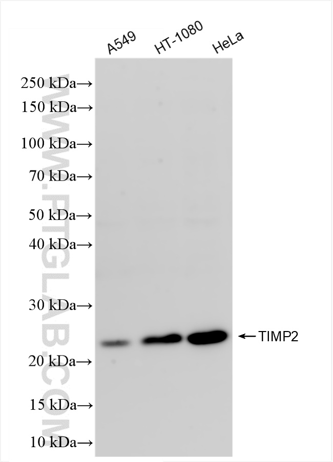 WB analysis using 83938-3-RR (same clone as 83938-3-PBS)