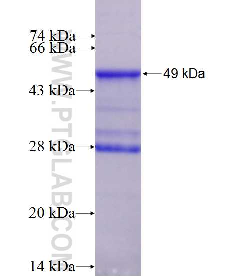 TIMP2 fusion protein Ag10413 SDS-PAGE TIMP2 fusion protein Ag10413 SDS-PAGE