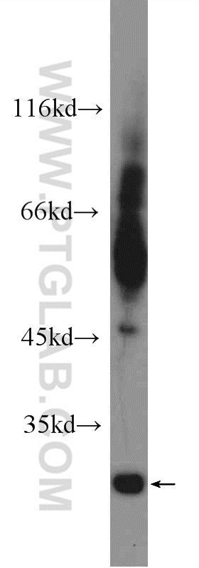 WB analysis of fetal human brain using 12326-1-AP