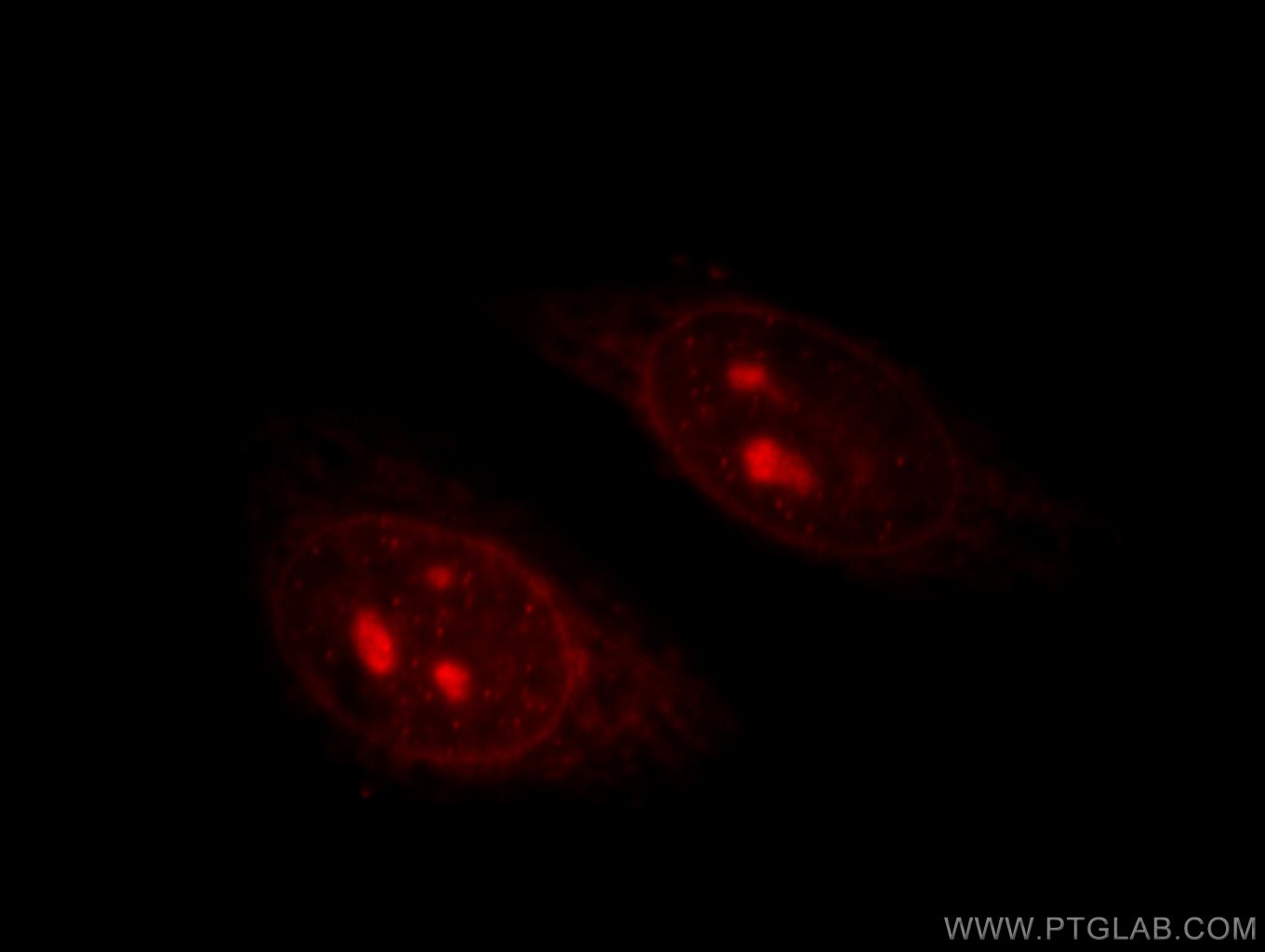 IF Staining of HepG2 using 11368-1-AP