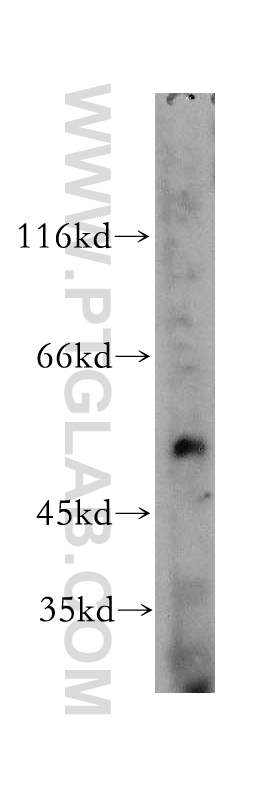 WB analysis of mouse spleen using 11368-1-AP