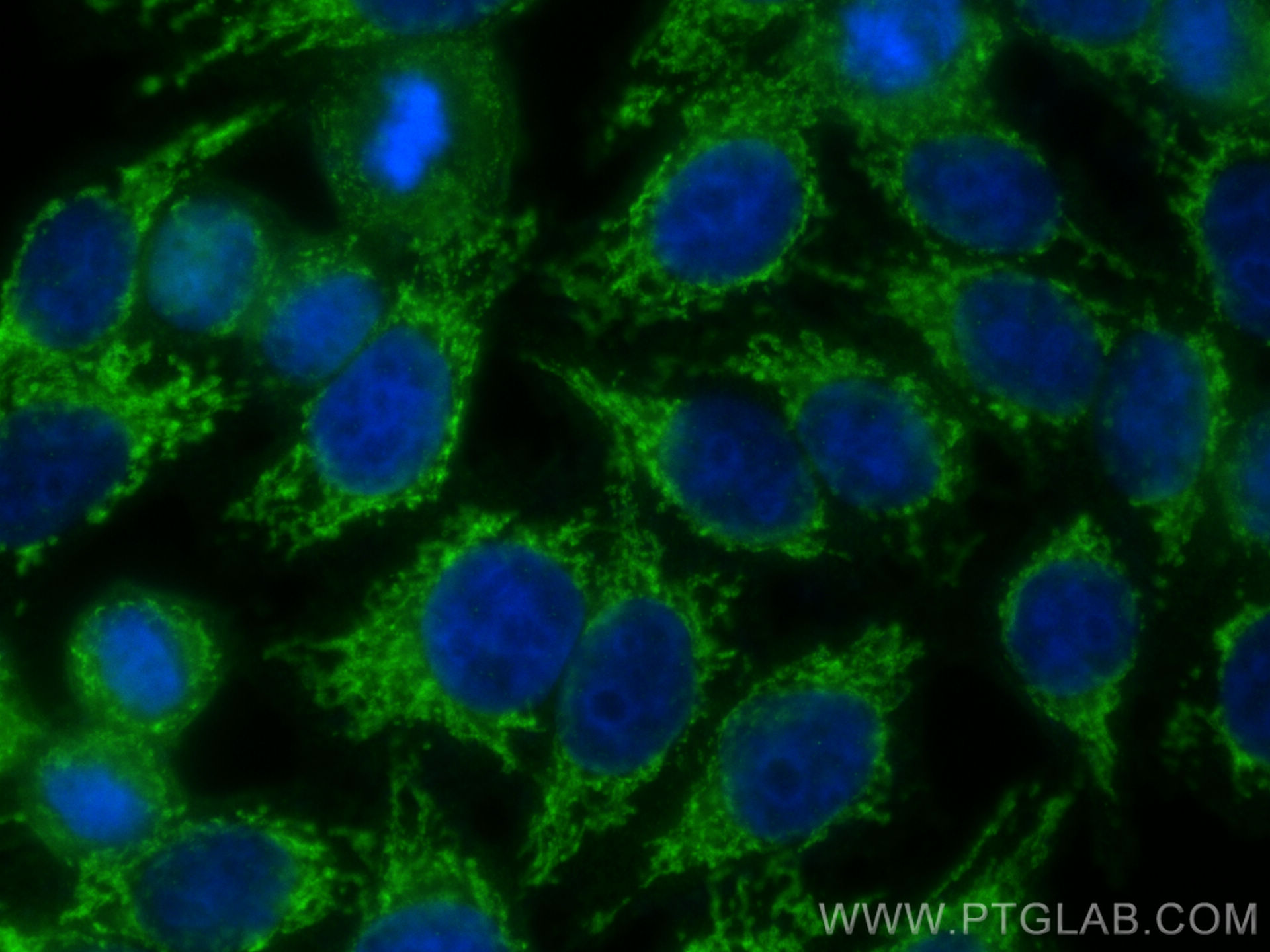 IF Staining of HepG2 using 12077-1-AP