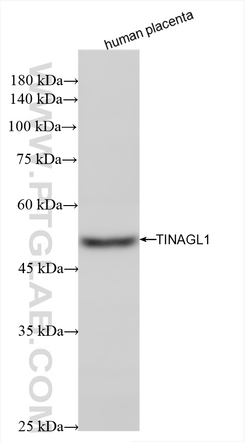 WB analysis using 85140-2-RR (same clone as 85140-2-PBS)