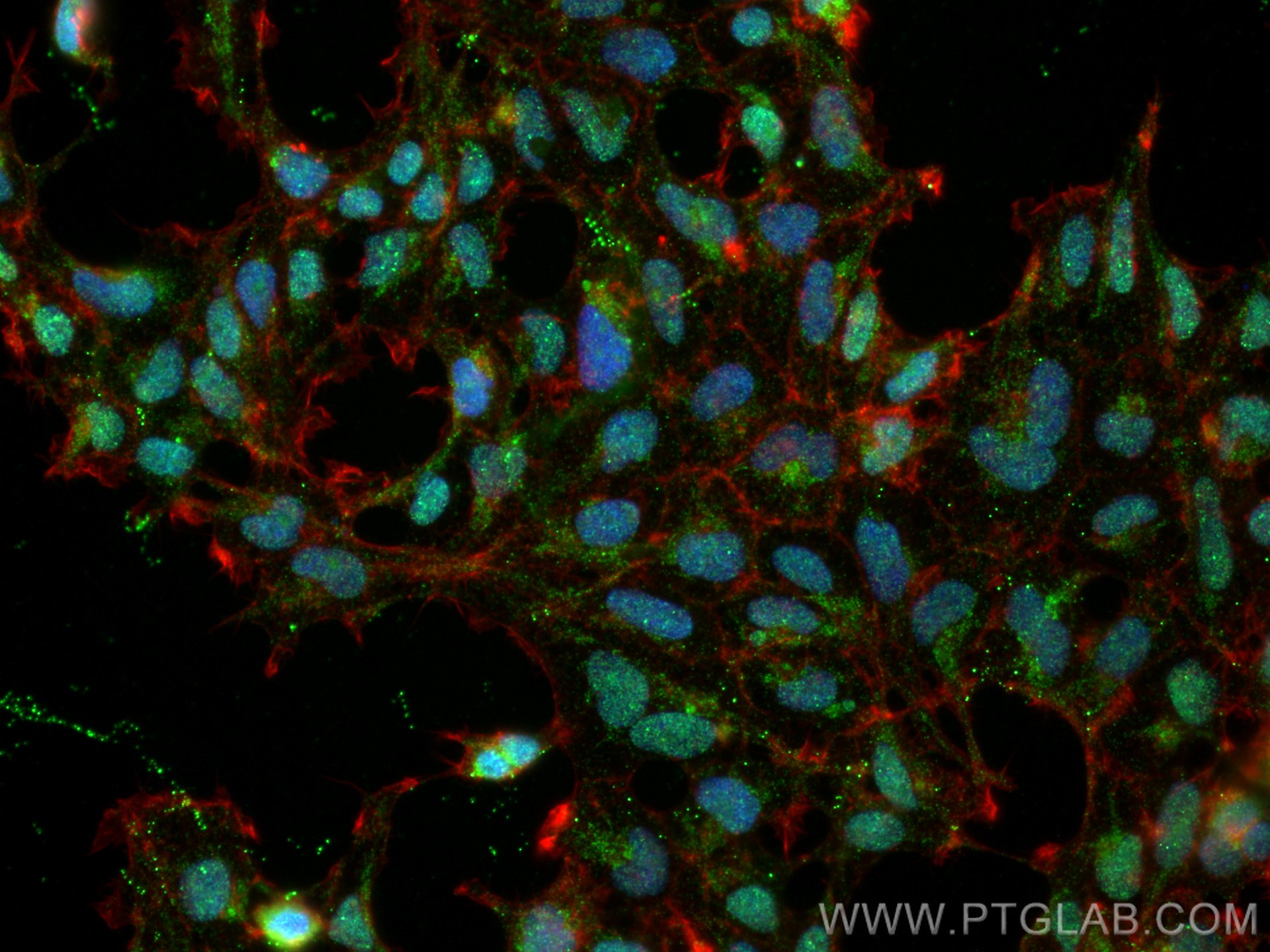 IF Staining of HEK-293 using 66374-1-Ig