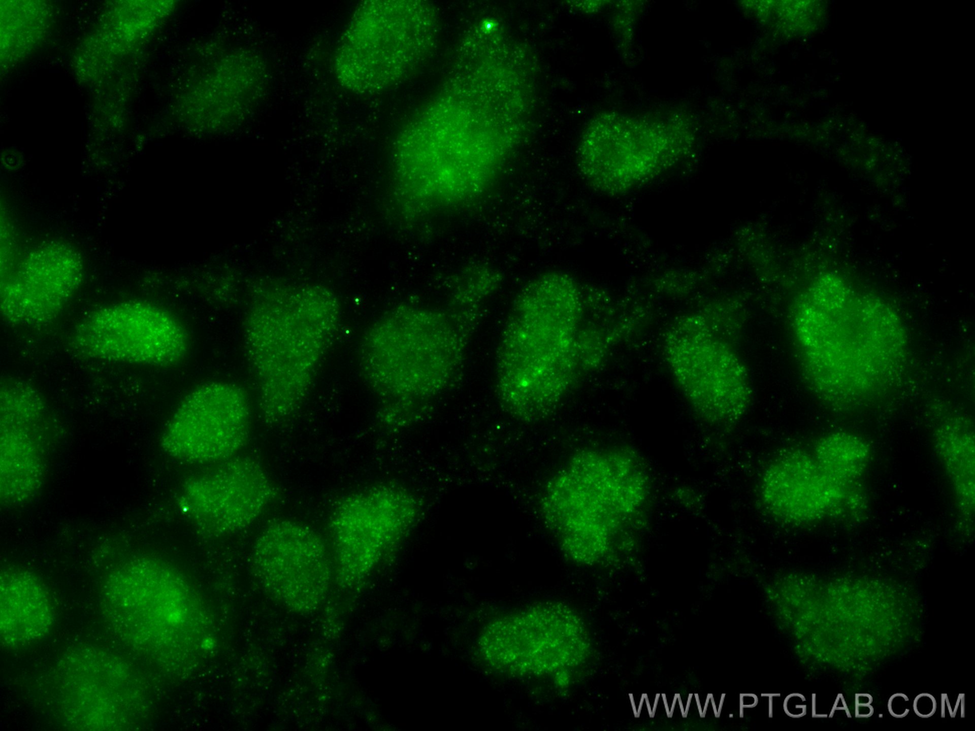 IF Staining of HEK-293 using 66374-1-Ig