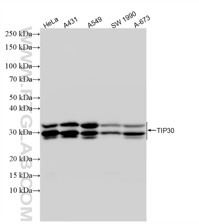 Various lysates were subjected to SDS PAGE followed by western blot with <a class='green' href='/productredirect?CatalogNo=86972-1-RR' target='_blank'>86972-1-RR</a> (TIP30 antibody) at dilution of 1:10000 incubated at room temperature for 1.5 hours. This data was developed using the same antibody clone with 86972-1-PBS in a different storage buffer formulation. WB analysis using 86972-1-RR (same clone as 86972-1-PBS)