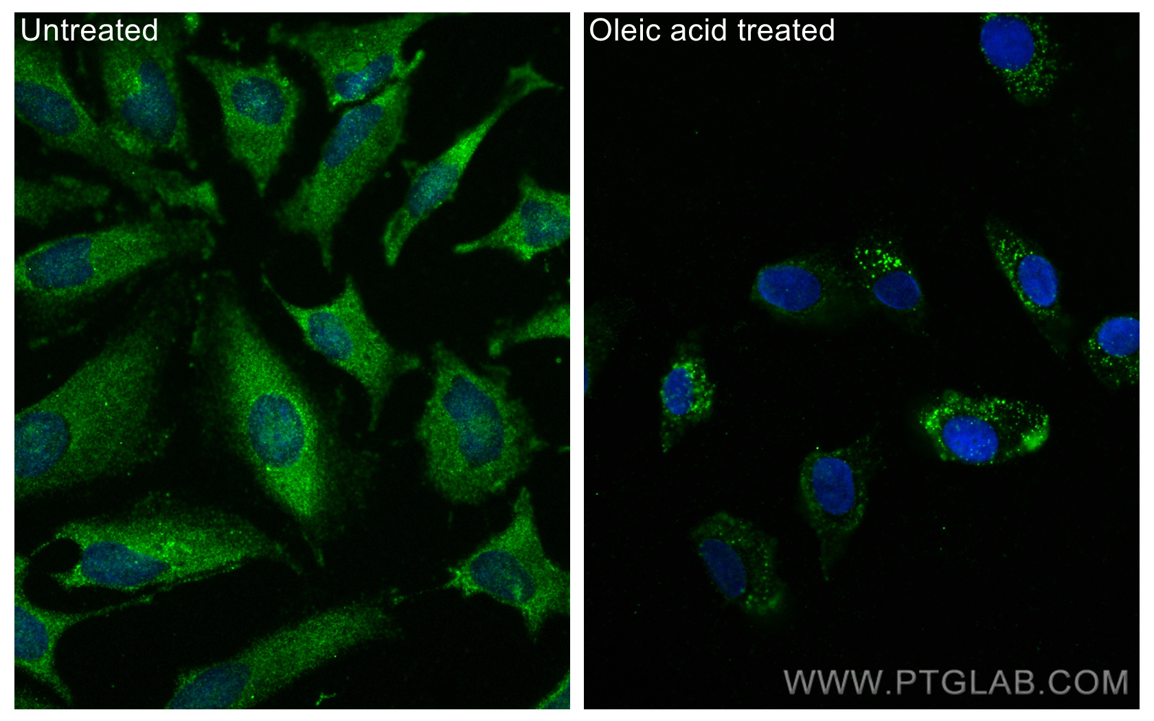 IF Staining of HeLa using 66523-1-Ig (same clone as 66523-1-PBS)