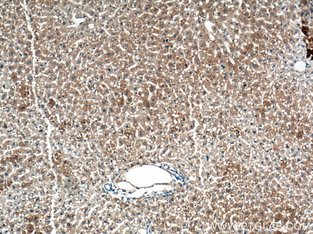 IHC staining of mouse liver using 66523-1-Ig (same clone as 66523-1-PBS)