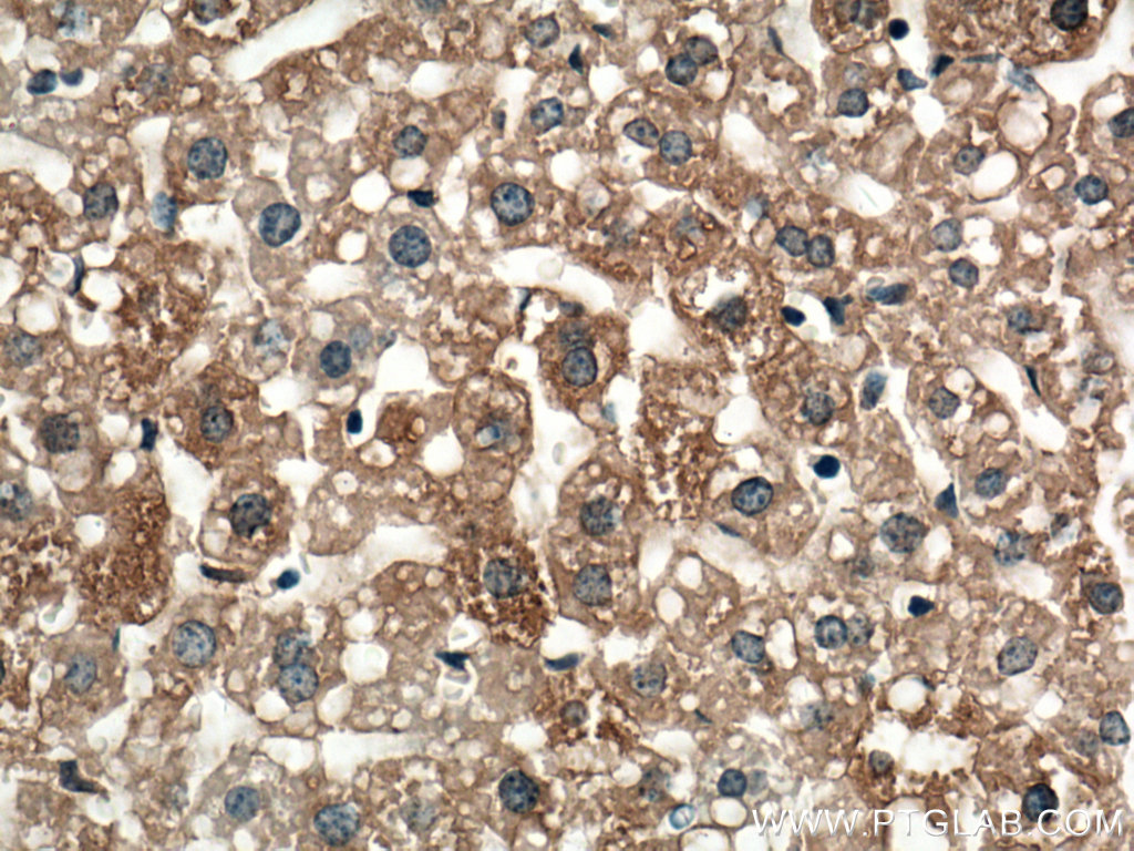 IHC staining of mouse liver using 66523-1-Ig (same clone as 66523-1-PBS)