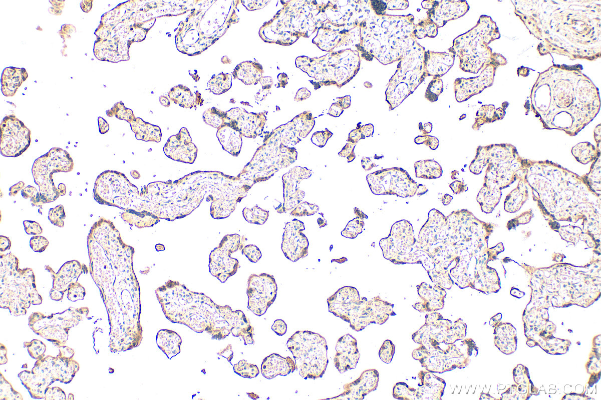 IHC staining of human placenta using 66523-1-Ig