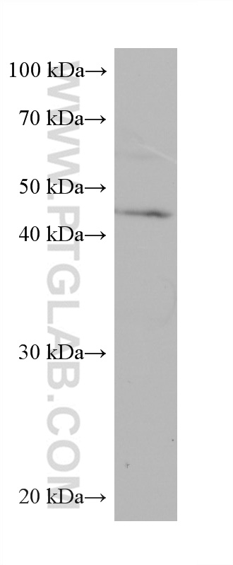 WB analysis of U2OS using 66523-1-Ig