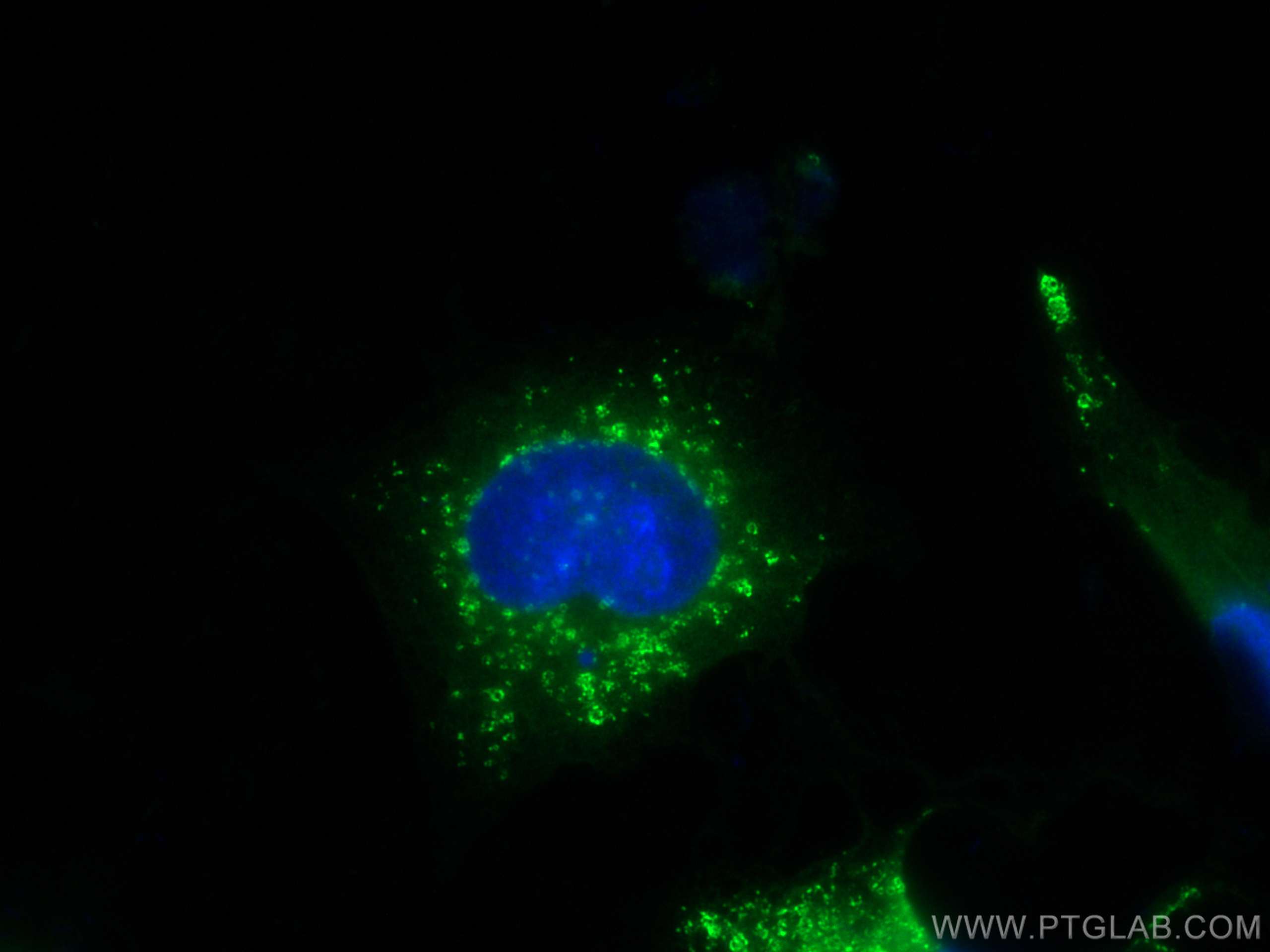 IF Staining of HUVEC using CL488-10694