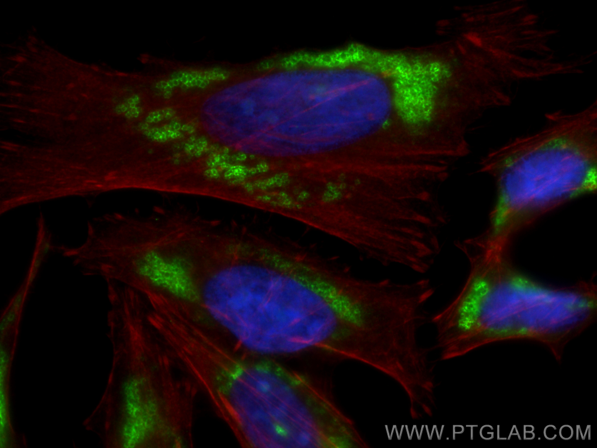 IF Staining of HeLa using CL488-10694