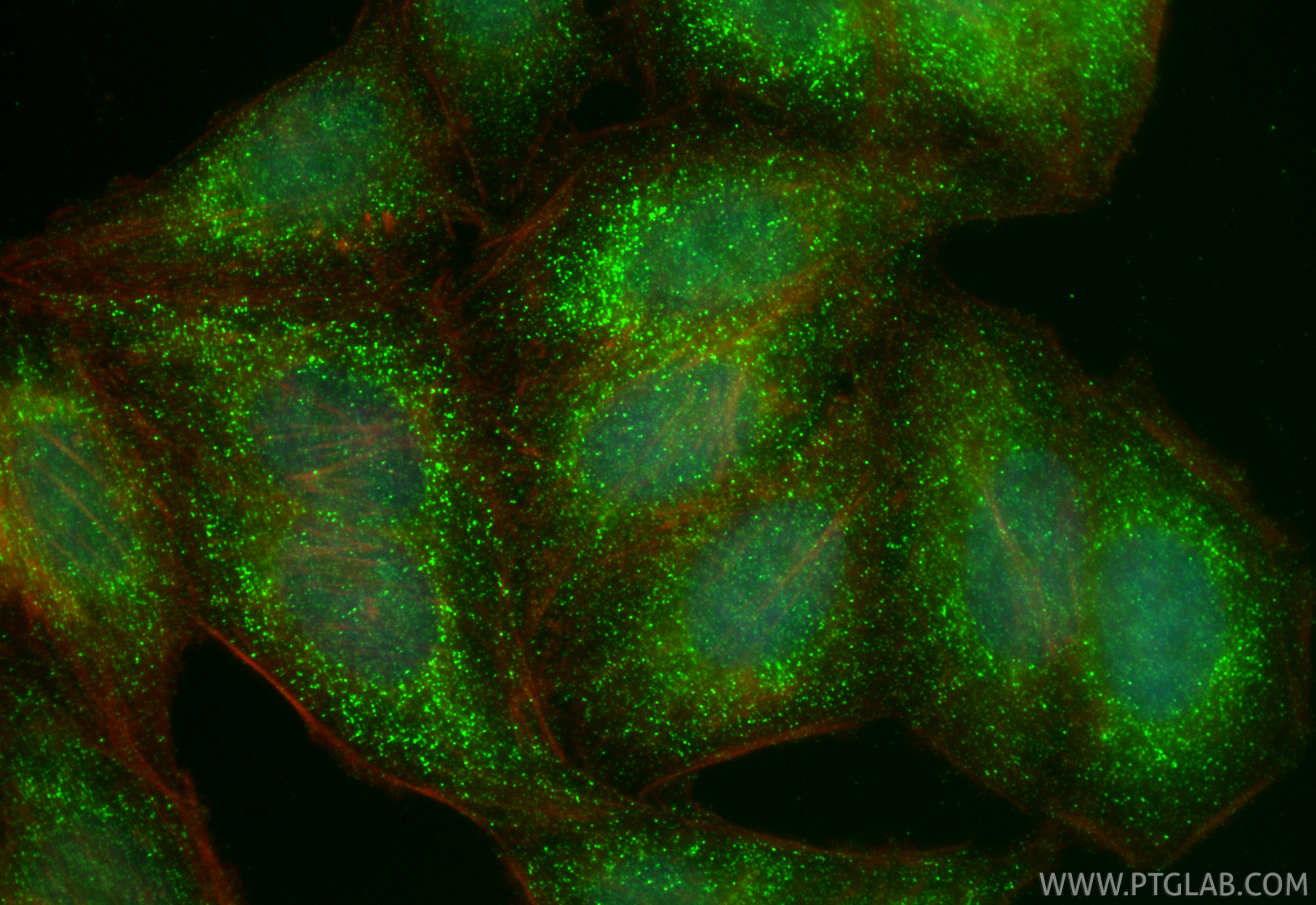 IF Staining of HepG2 using RMX00083 IF Staining of HepG2 using RMX00083