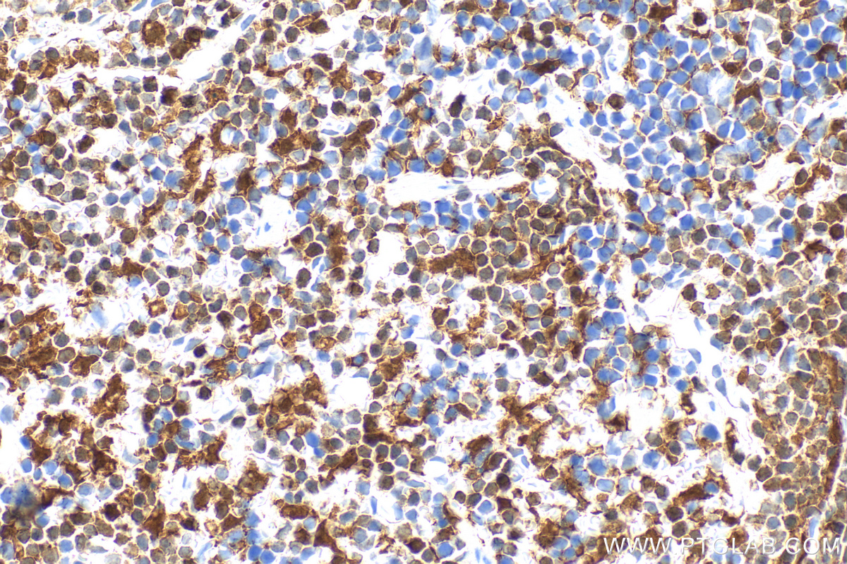 IHC staining of mouse spleen using RMX00083 IHC staining of mouse spleen using RMX00083