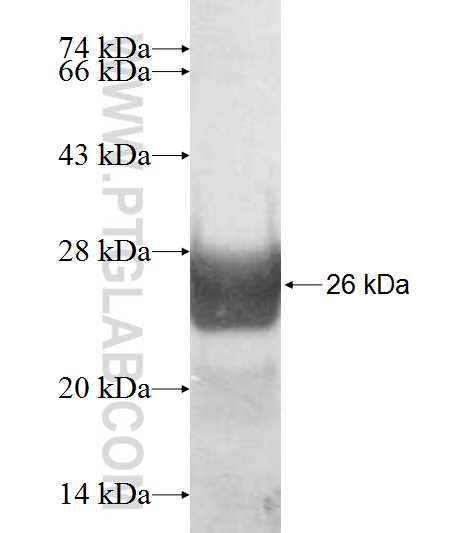 TIPRL fusion protein Ag8951 SDS-PAGE TIPRL fusion protein Ag8951 SDS-PAGE