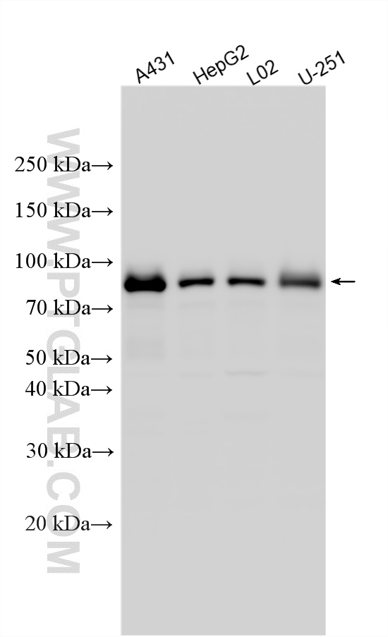 Various lysates were subjected to SDS PAGE followed by western blot with 17734-1-AP (TJAP1 antibody) at dilution of 1:1000 incubated at room temperature for 1.5 hours. WB analysis using 17734-1-AP
