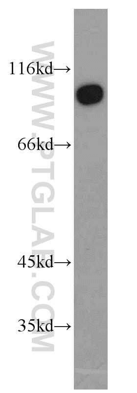 WB analysis of human skeletal muscle using 17734-1-AP