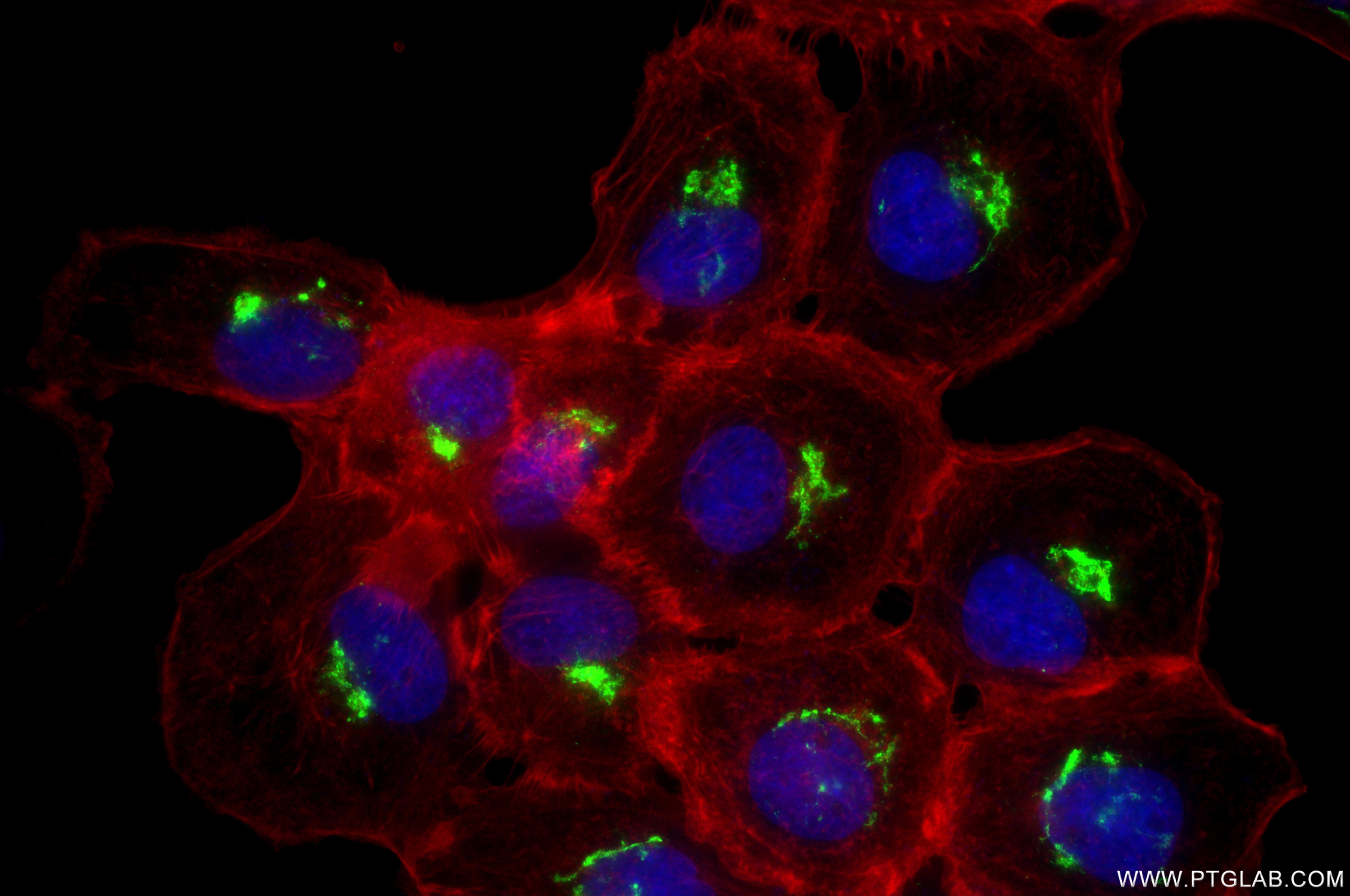 IF Staining of A431 using 87106-3-RR