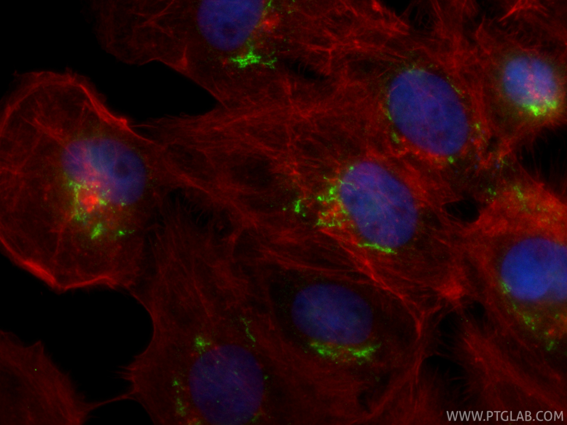 IF Staining of A431 using CL488-87106-3 IF Staining of A431 using CL488-87106-3