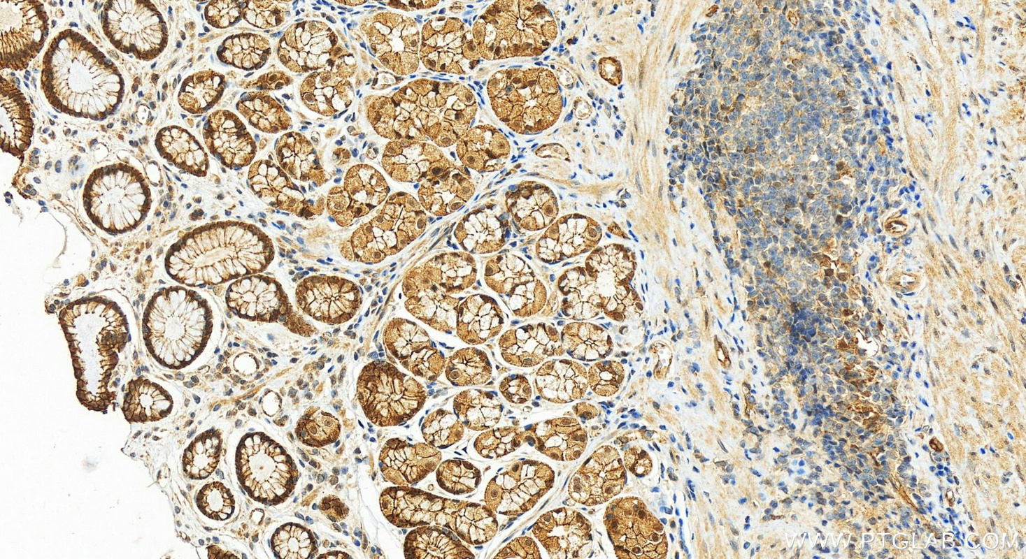 IHC staining of human stomach using 18900-1-AP