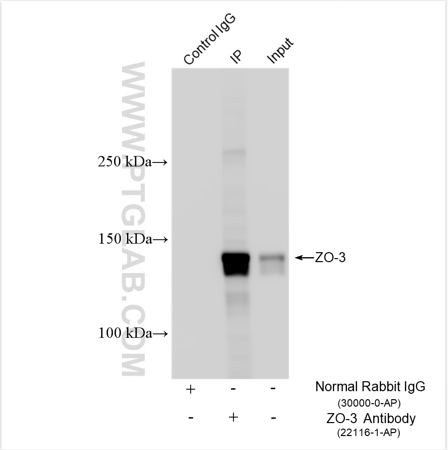 IP experiment of HT-29 using 22116-1-AP